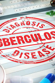 FM Nirmala Sitharaman wants to eradicate TB by 2025: Know causes, symptoms & treatment of the disease FM Nirmala Sitharaman wants to eradicate TB by 2025: Know causes, symptoms & treatment of the disease